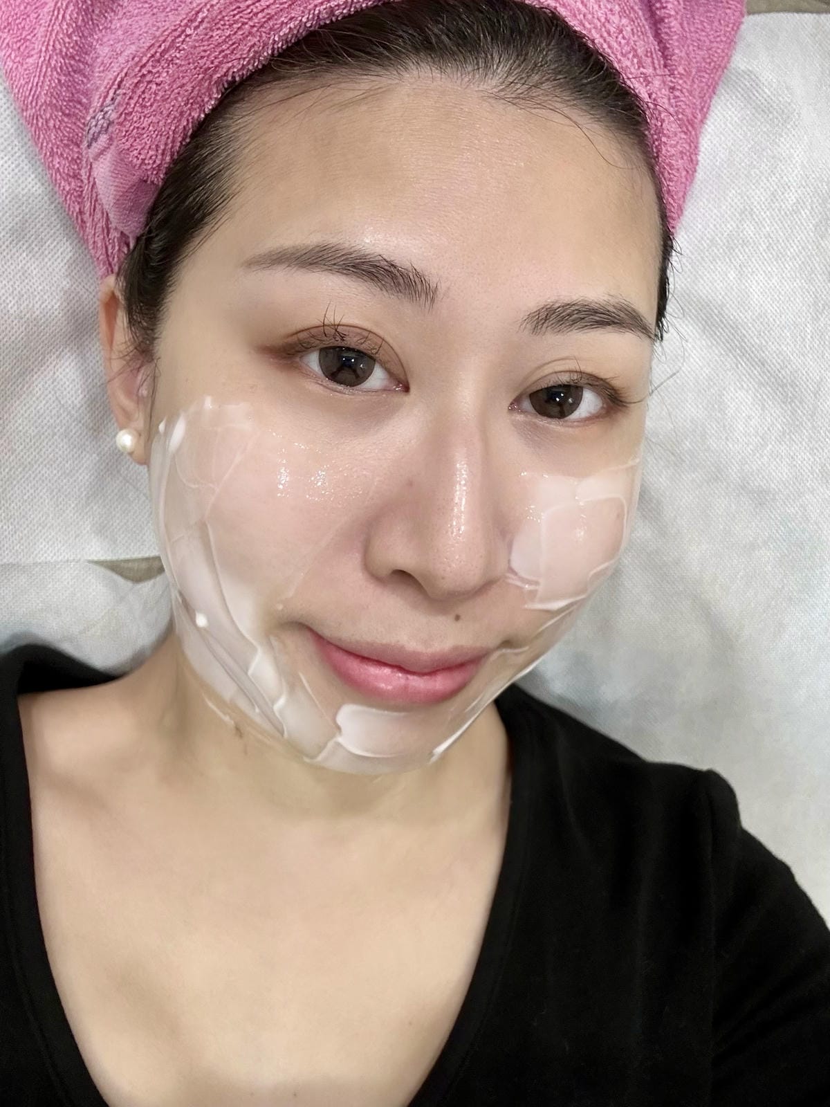 《 台北醫美分享 》台北東妍診所|IG 電波+第三代海芙音波 《 台北醫美分享 》台北東妍診所|IG 電波+第三代海芙音波