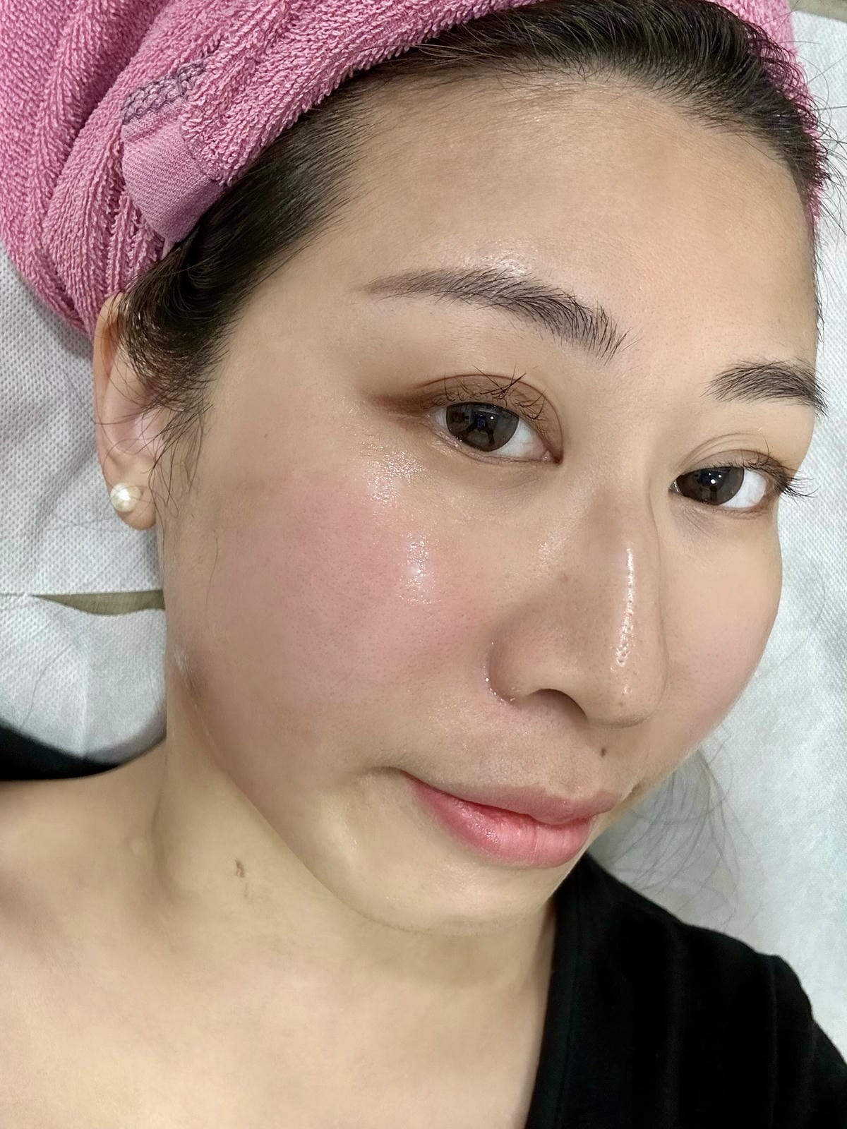 《 台北醫美分享 》台北東妍診所|IG 電波+第三代海芙音波 《 台北醫美分享 》台北東妍診所|IG 電波+第三代海芙音波